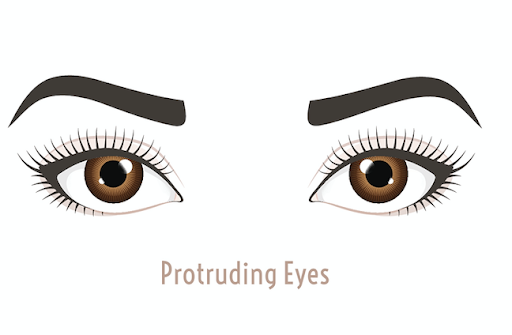 protruding eyes