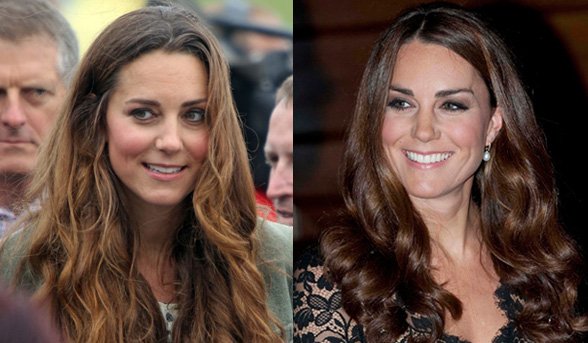 The Duchess of Cambridge’s post pregnancy problem