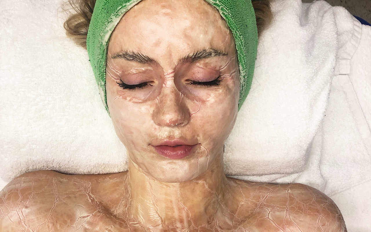 We try the DMK enzyme therapy aka the ‘Game Of Thrones’ facial