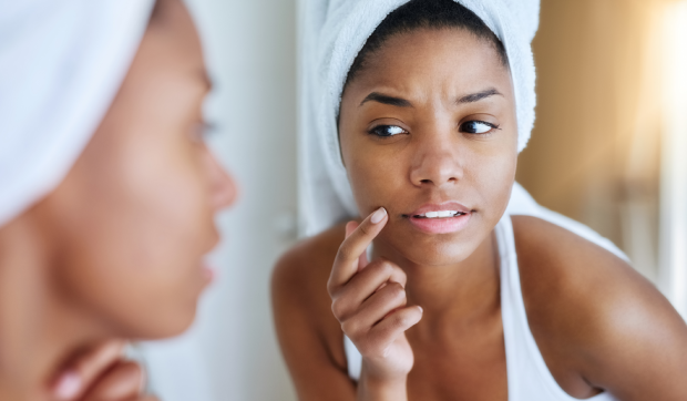 Your Guide To The 6 Different Types Of Pimples