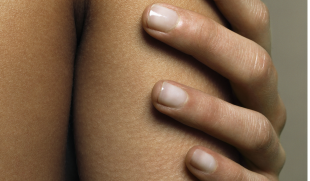 Everything you need to know about keratosis pilaris