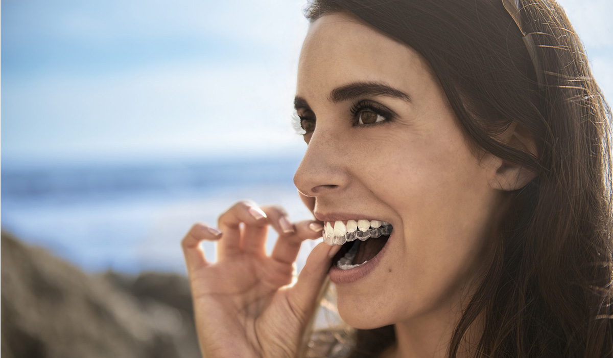 Everything you need to know about Invisalign treatment