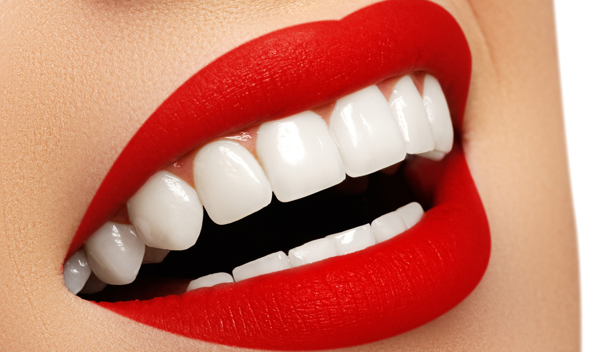 Teeth whitening myths and facts