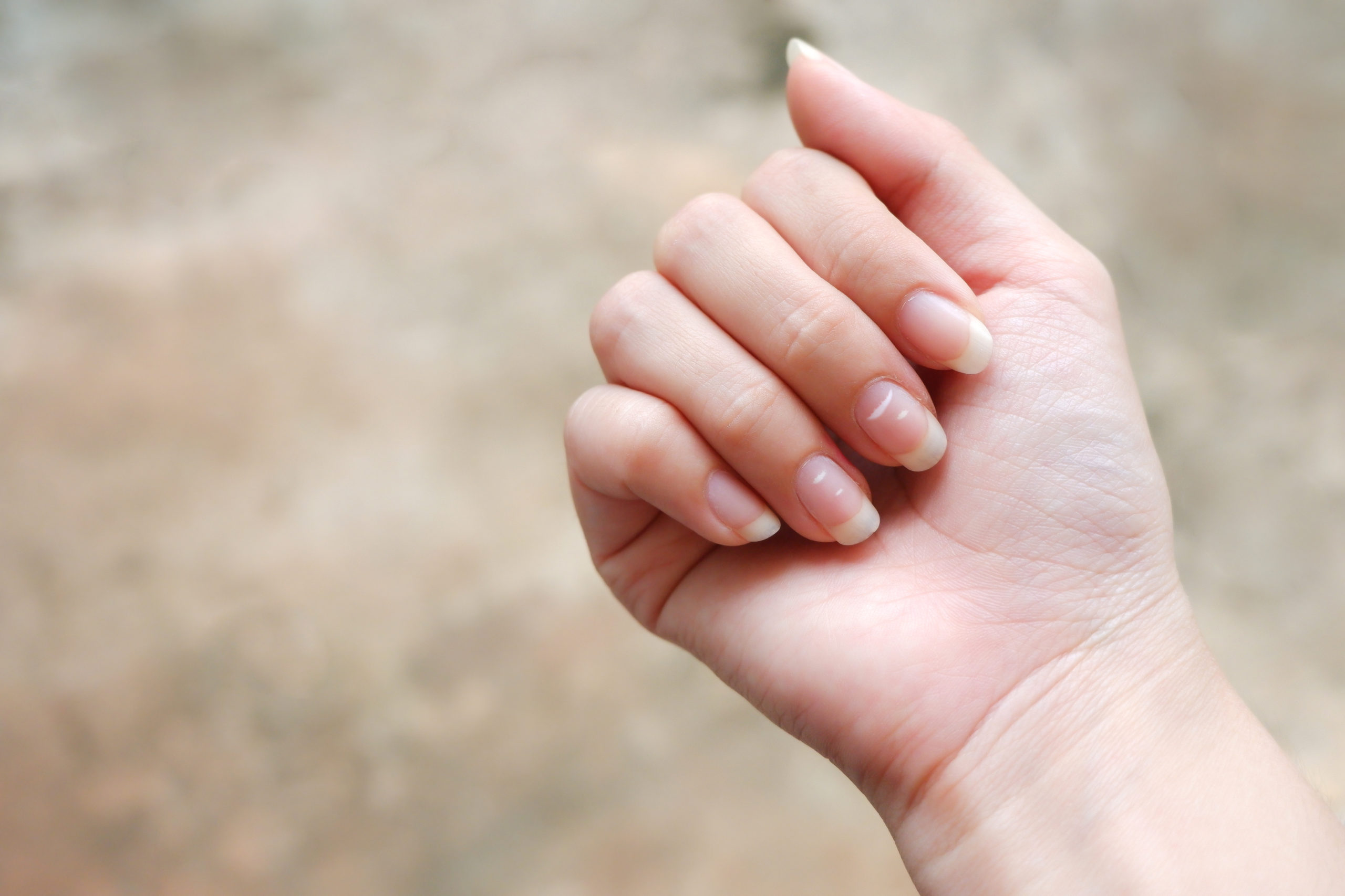 white spots on nails